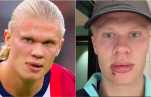 Erling Haaland sofre lesão facial estranha no ônibus da seleção norueguesa