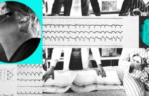 A tecnologia está remodelando o tratamento da apneia do sono