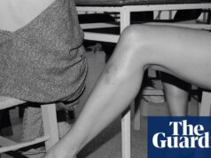 ‘Braços e pernas são muito expressivos, principalmente com hematomas’: a fotografia absurda de Yorgos Lanthimos