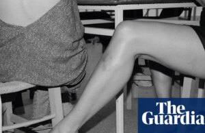 ‘Braços e pernas são muito expressivos, principalmente com hematomas’: a fotografia absurda de Yorgos Lanthimos