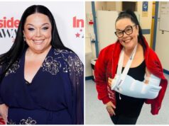 Lisa Riley correu para o hospital depois de uma ‘queda muito forte’ que a deixou precisando de cirurgia