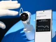 O Google quer preencher o Fitbit com IA – e seus registros médicos