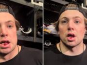 McAvoy perdeu o bis dos dentes, mas jogou os heróis