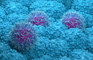 O potencial medicamento inovador contra o câncer de pâncreas da Revolution Medicines é bem-sucedido em testes em estágio remaining