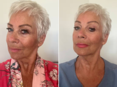 O soro Boots de £ 18 aprovado por Denise Welch para pescoços caídos faz com que os clientes ‘envelheçam para trás’