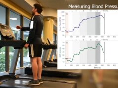 Esqueça os smartwatches, em breve suas roupas poderão monitorar sua saúde