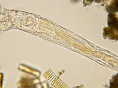 Cientistas revivem o antigo ‘verme zumbi’ de 24.000 anos do gelo do Ártico – então ele se reproduziu