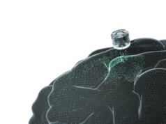 Um implante cerebral para depressão está prestes a ser testado em humanos