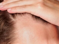 ‘Rogaine’ em uma pílula? Minoxidil Oral Aces Grande Teste de Queda de Cabelo