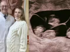 ‘Uma em 15,5 milhões’: mulher na Rússia dá à luz quatro meninas idênticas