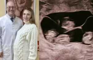 ‘Uma em 15,5 milhões’: mulher na Rússia dá à luz quatro meninas idênticas