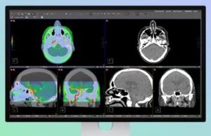 Apple Studio Show XDR agora aprovado pela FDA para uso em radiologia diagnóstica
