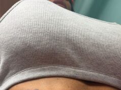 Katie Worth revela nova tatuagem que diz ‘Owned by Lee’ no último ato de dedicação ao marido Lee Andrews após um casamento turbulento