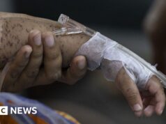 Centenas de crianças morrem em poucos meses enquanto os casos de sarampo aumentam em Bangladesh