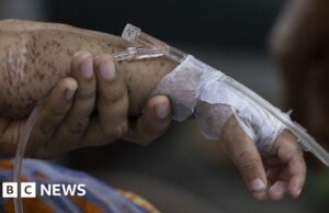 Centenas de crianças morrem em poucos meses enquanto os casos de sarampo aumentam em Bangladesh