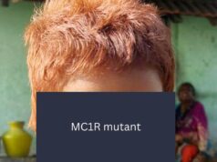 Cientistas do CCMB identificam gene raro por trás do cabelo ruivo de menina indiana