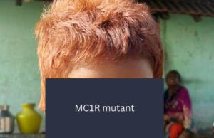 Cientistas do CCMB identificam gene raro por trás do cabelo ruivo de menina indiana