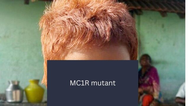MC1R.jpg