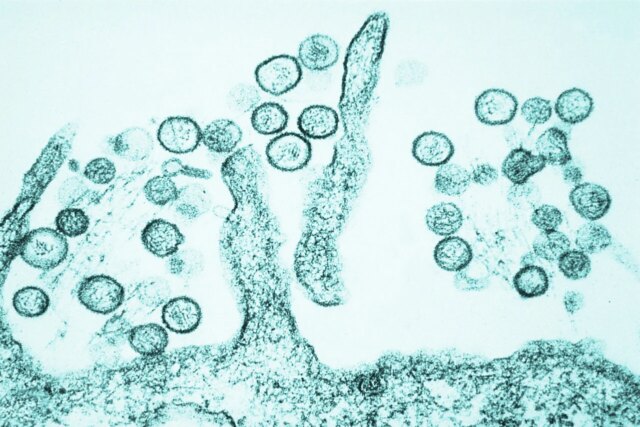 Sin_Nombre_hanta_virus_-1280x853.jpg