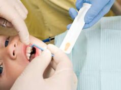 Anos sem água fluoretada mostram padrão de cárie dentária que especialistas alertaram sobre