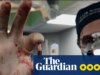 A revisão da missão – um cirurgião salva vidas em Gaza devastada pela guerra num retrato visceral da resistência humana