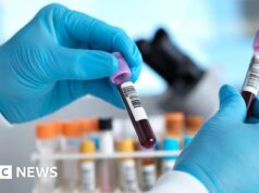Dois possíveis casos de Ebola no Brasil foram descartados porque os pacientes testaram negativo