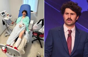 Estrela do SNL UK correu para o hospital depois de ‘lacerar’ a mão com uma espada