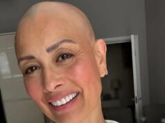 Melanie Sykes orgulhosamente revela novo visible depois de perder o cabelo devido à alopecia