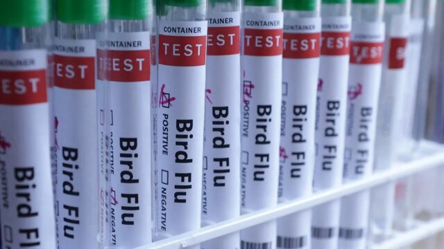 bird-flu-test-tubes-fox-news-001.jpeg