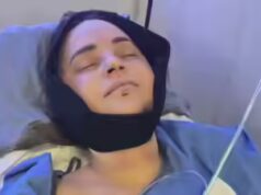 YouTuber Rosanna Pansino passa por cirurgia após quebrar mandíbula em acidente de barco
